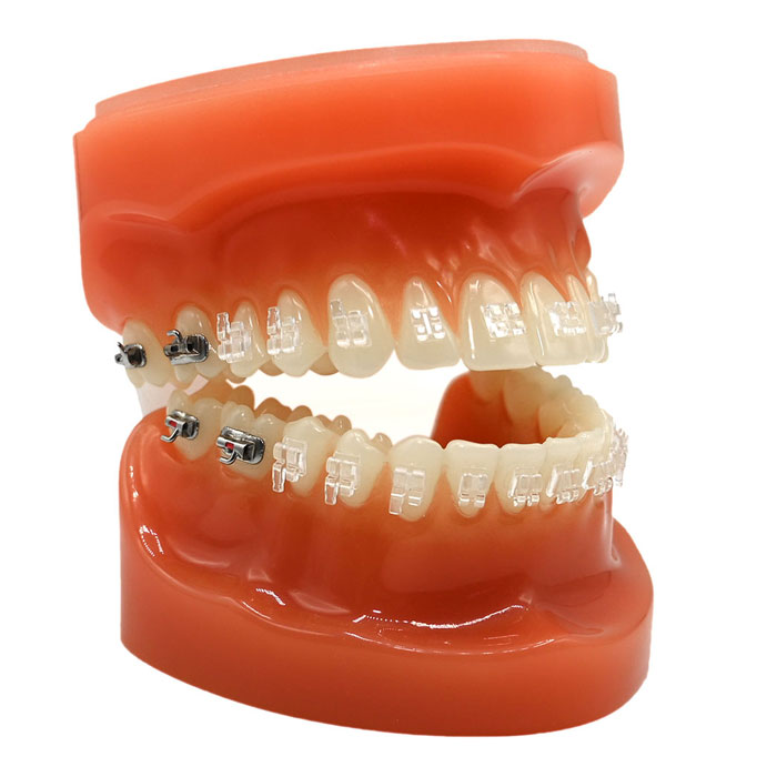 تایپودونت مدل دندان American Orthodantics - 1