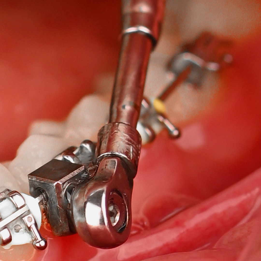 پاور اسکوپ 2 American Orthodontics - 8