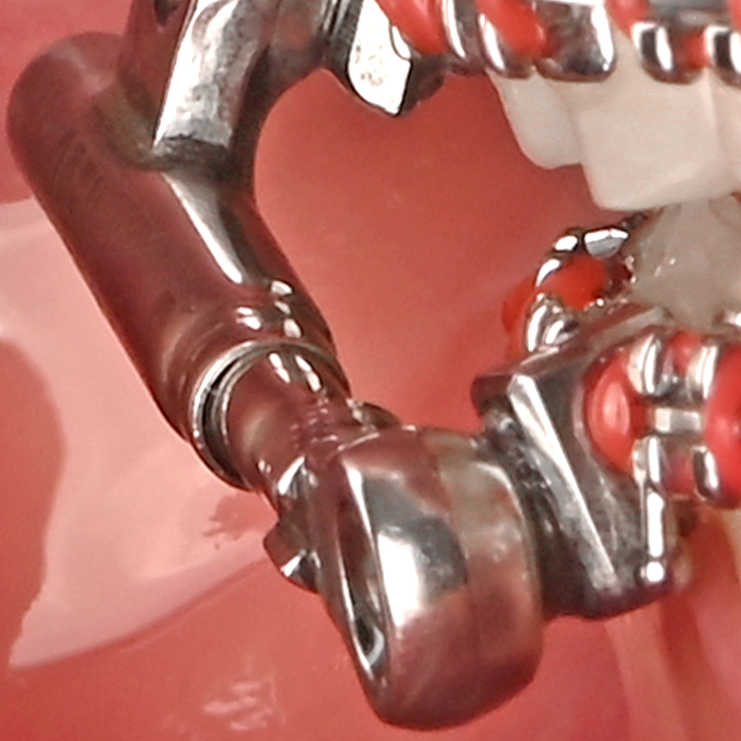 پاور اسکوپ 2 American Orthodontics - 7