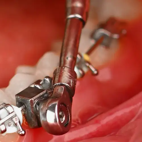 پاور اسکوپ 2 American Orthodontics - 8