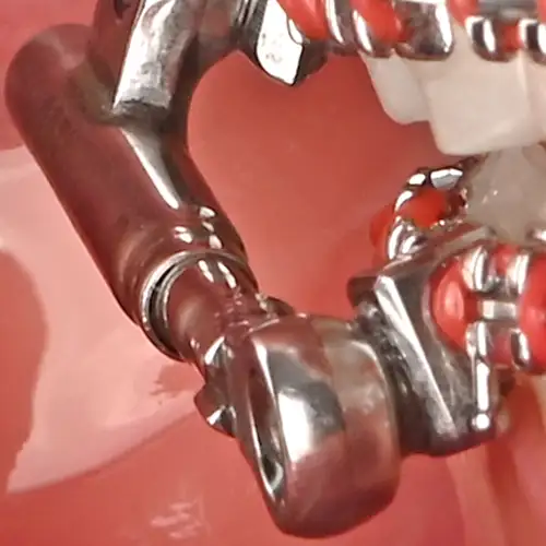 پاور اسکوپ 2 American Orthodontics - 7
