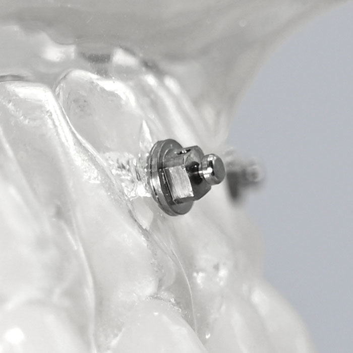 پیچ مینی اسکرو Ortho Organizer - 1