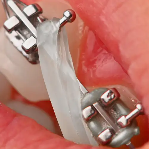 لاتکس G&H - 10